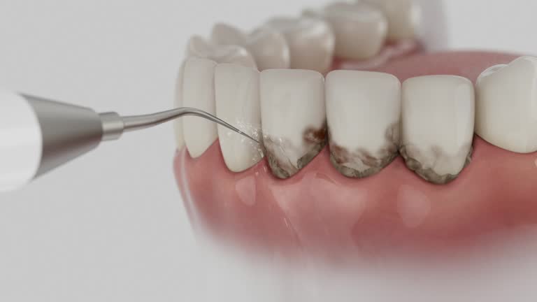 Trusted Dental Implants service in Madera Ranchos, CA - Dentist Open Now